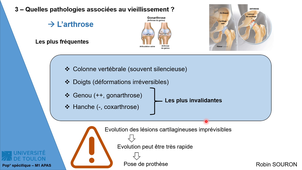CM3 VIEILLISSEMENT - ROBIN SOURON (M1 APAS)