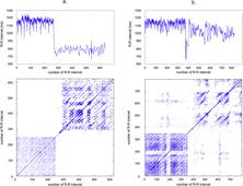 M1 - EOPS - Introduction à l'étude de la Variabilité de la Fréquence Cardiaque - 4