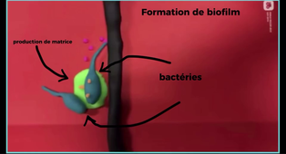 videoRAB46-equipe2-Pseudomonas-Limasset-Lecomte-Lindron.MOV