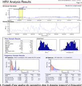 M1 - EOPS - Introduction à l'étude de la Variabilité de la Fréquence Cardiaque - 3